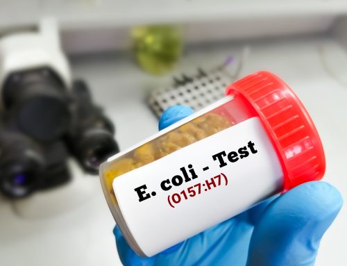 Stay Safe: Tips to Protect Yourself from the E.coli Outbreak